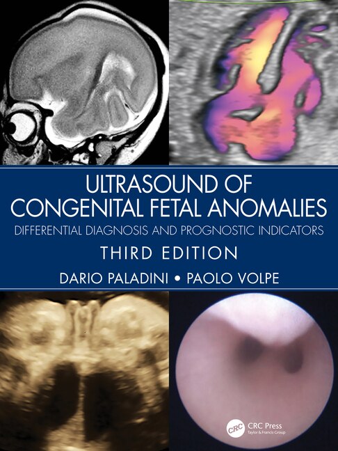 Front cover_Ultrasound of Congenital Fetal Anomalies