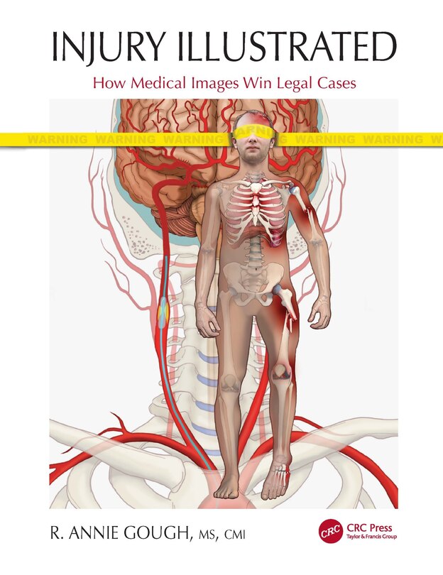 Front cover_Injury Illustrated