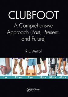 Front cover_Clubfoot