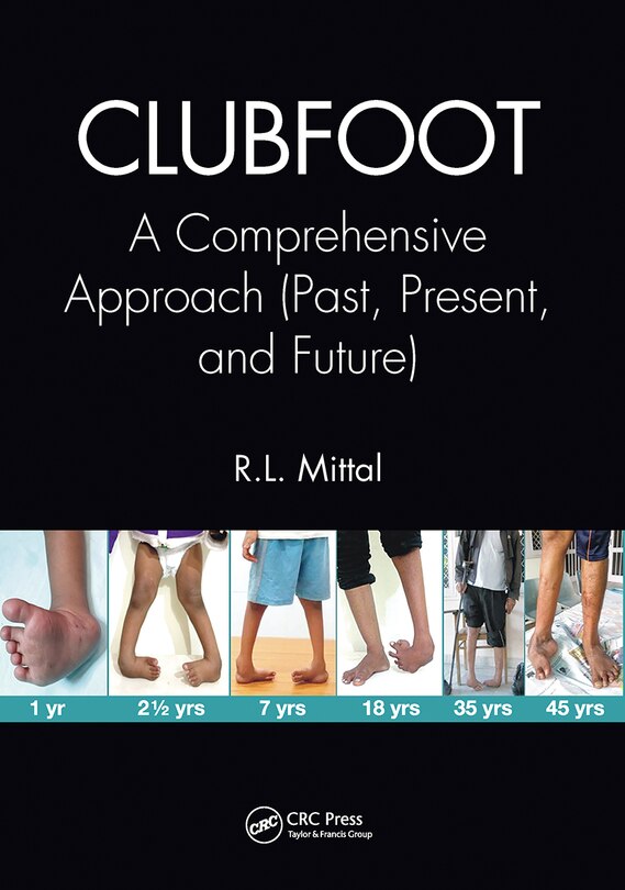 Front cover_Clubfoot