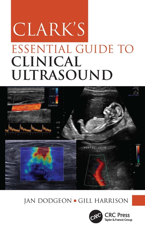 Front cover_Clark's Essential Guide to Clinical Ultrasound