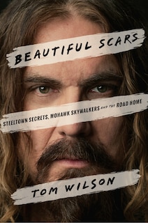 Front cover_Beautiful Scars