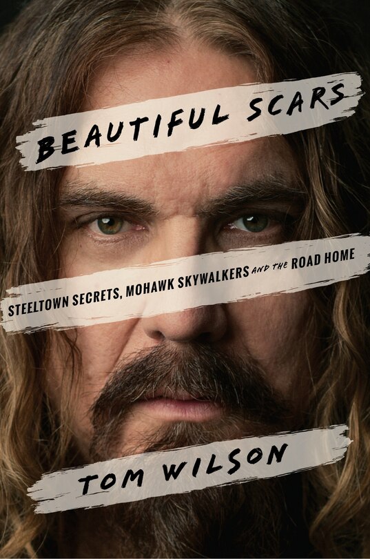 Front cover_Beautiful Scars