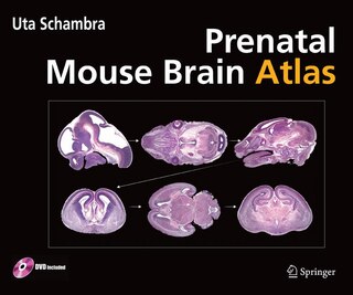Prenatal Mouse Brain Atlas: Color images and annotated diagrams of: Gestational Days 12, 14, 16 and 18 Sagittal, coronal and horizontal section