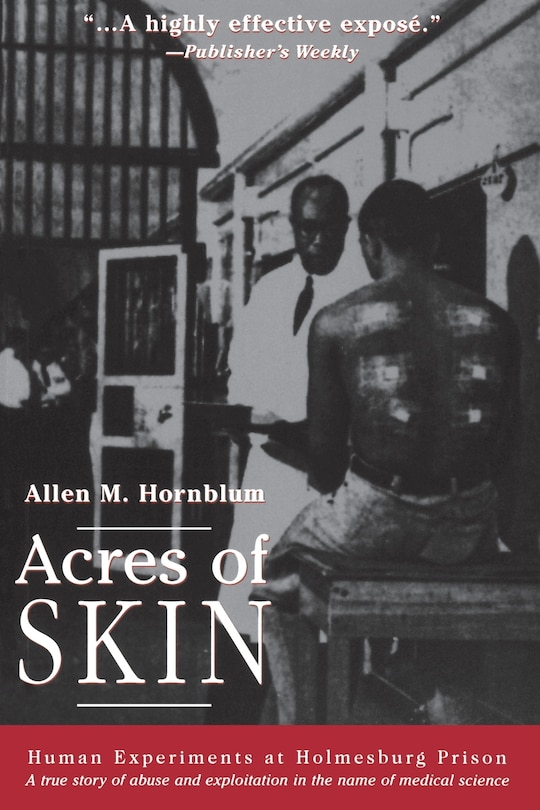 Couverture_Acres of Skin