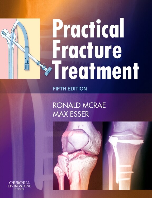 Couverture_Practical Fracture Treatment