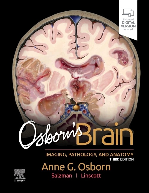 Front cover_Osborn's Brain
