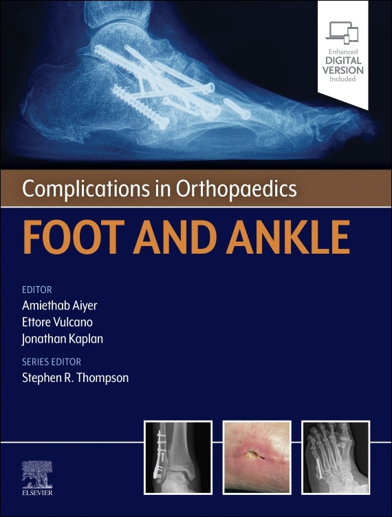 Front cover_Complications in Orthopaedics