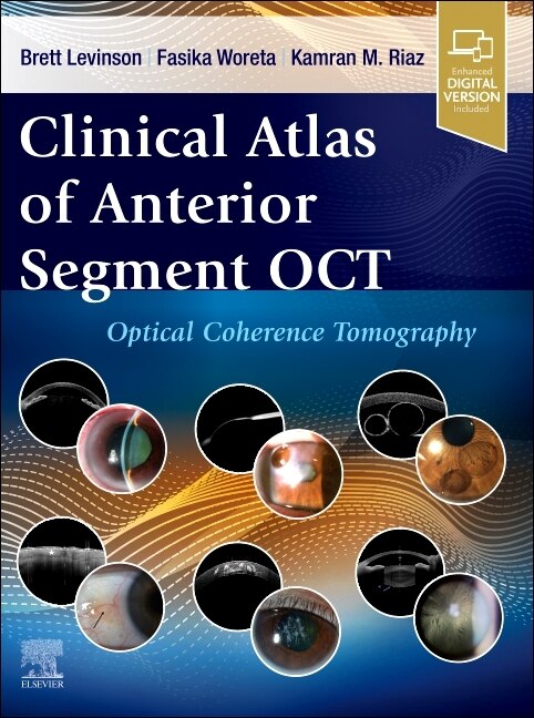 Front cover_Clinical Atlas of Anterior Segment OCT