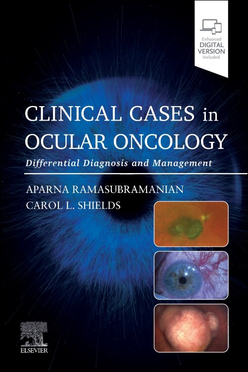 Front cover_Clinical Cases in Ocular Oncology