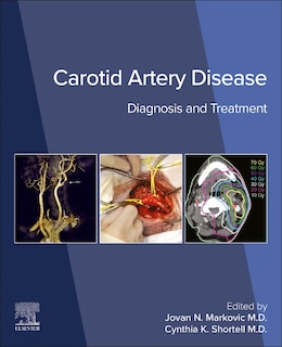 Front cover_Carotid Artery Disease