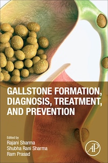 Front cover_Gallstone formation, diagnosis, treatment and prevention
