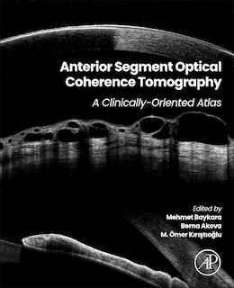 Front cover_Anterior Segment Optical Coherence Tomography