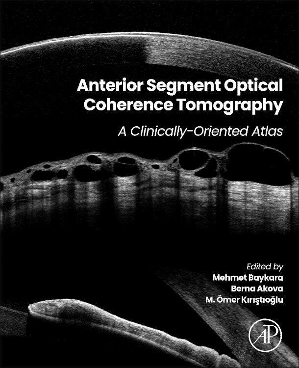 Front cover_Anterior Segment Optical Coherence Tomography
