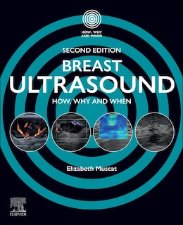 Front cover_Breast Ultrasound