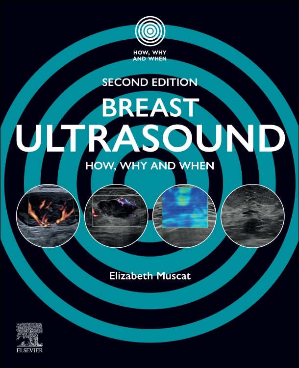Front cover_Breast Ultrasound