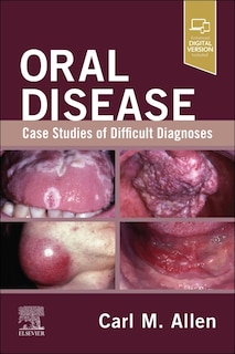 Front cover_Oral Disease