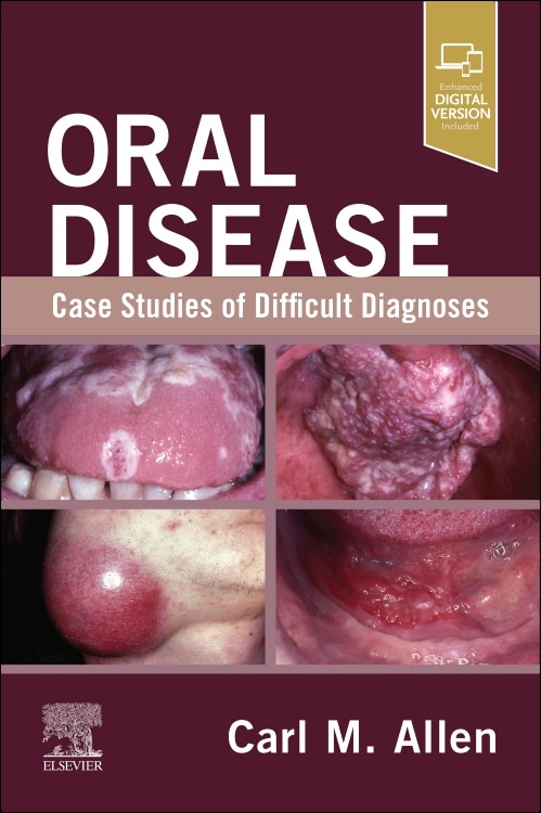Front cover_Oral Disease