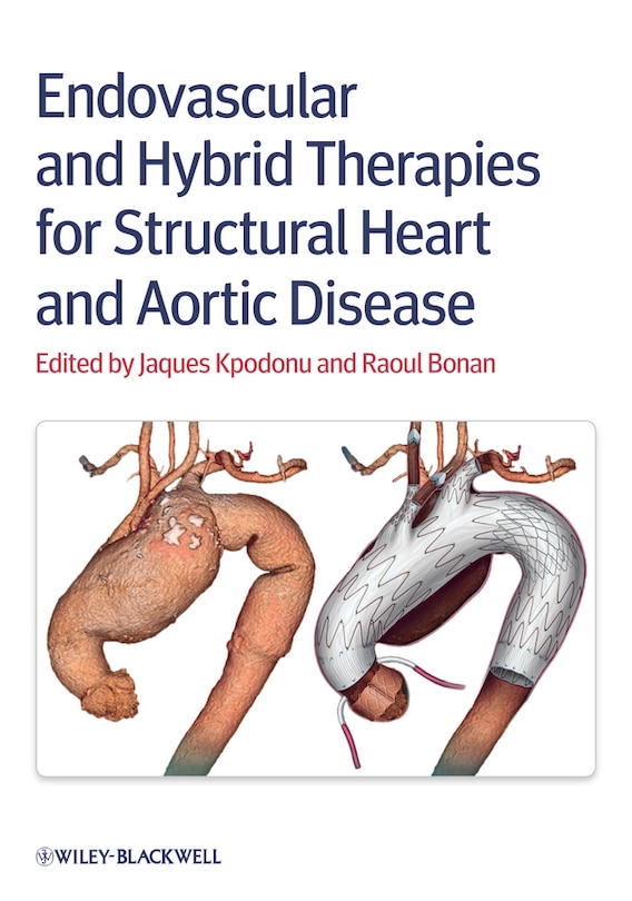 Couverture_Endovascular and Hybrid Therapies for Structural Heart and Aortic Disease