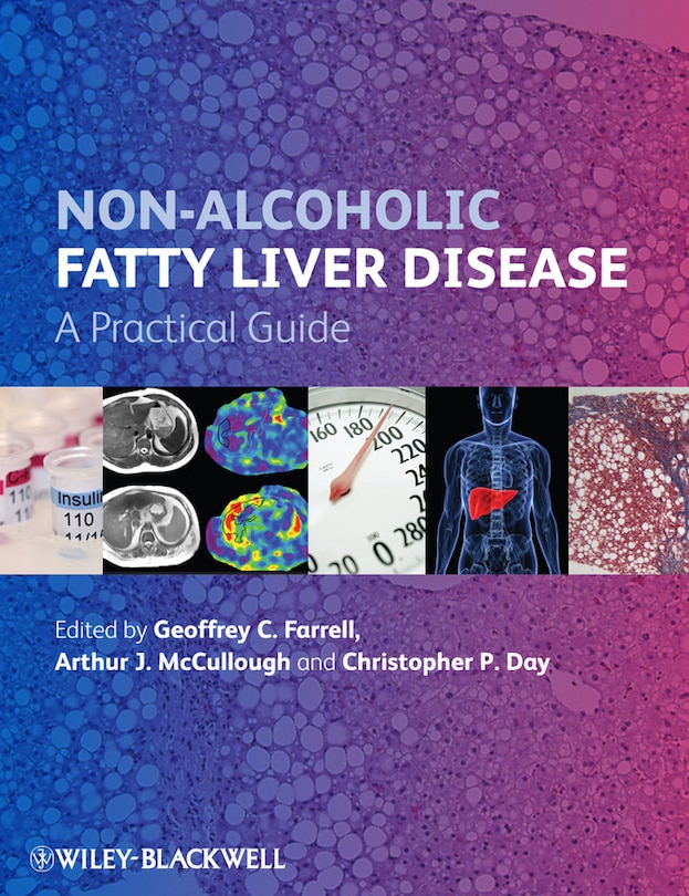 Front cover_Non-Alcoholic Fatty Liver Disease