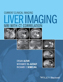 Front cover_Liver Imaging