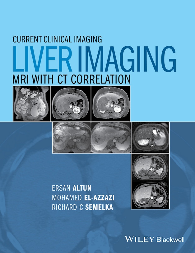 Front cover_Liver Imaging