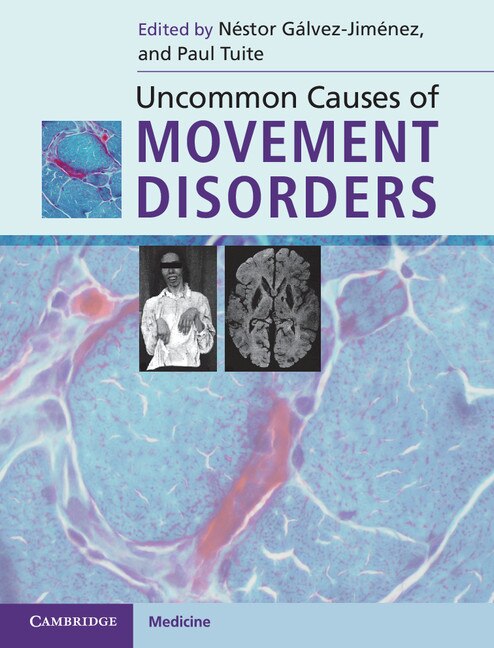 Couverture_Uncommon Causes of Movement Disorders