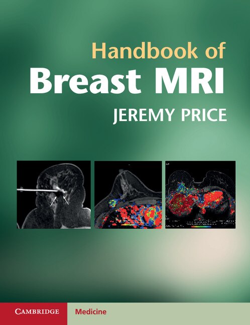 Front cover_Handbook of Breast MRI