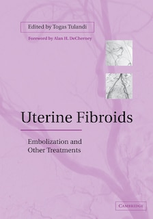 Front cover_Uterine Fibroids