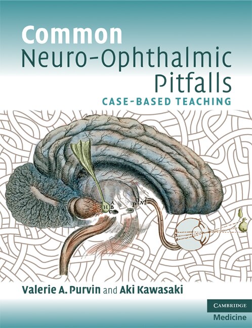 Front cover_Common Neuro-Ophthalmic Pitfalls