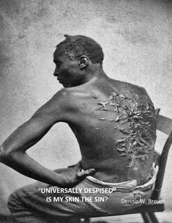 Front cover_Universally Despised Is My Skin the Sin?