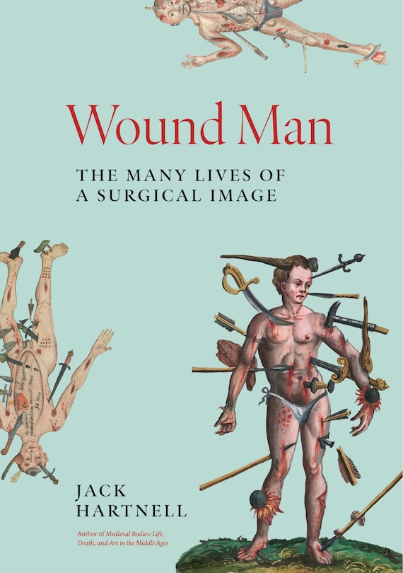 Couverture_Wound Man