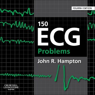 Front cover_150 Ecg Problems