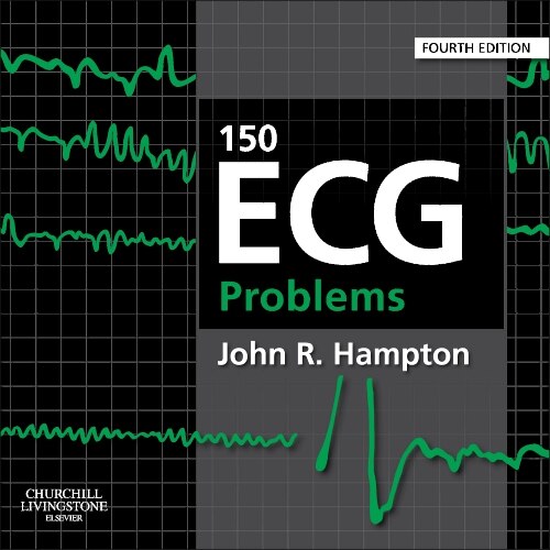 Front cover_150 Ecg Problems