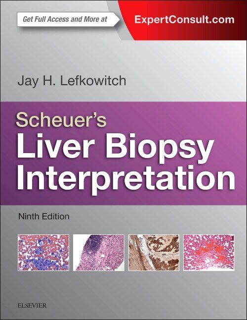 Front cover_Scheuer's Liver Biopsy Interpretation