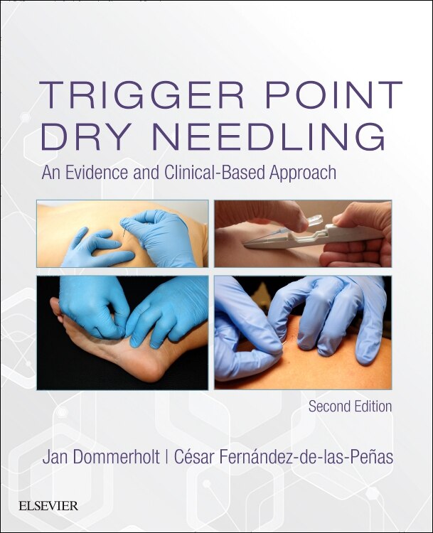 Front cover_Trigger Point Dry Needling