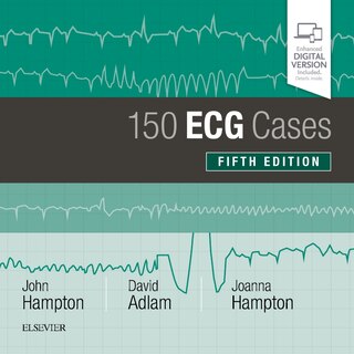 Couverture_150 Ecg Cases