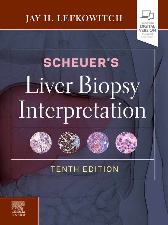 Front cover_Scheuer's Liver Biopsy Interpretation