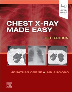 Front cover_Chest X-ray Made Easy