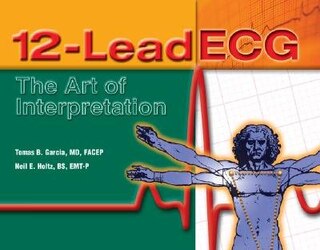 12-lead Ecg: The Art Of Interpretation: The Art of Interpretation