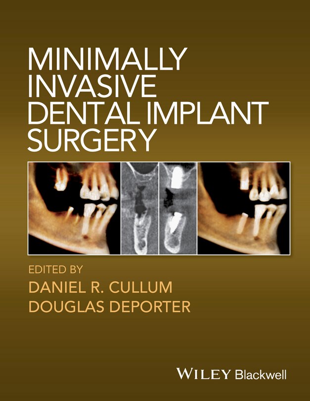 Couverture_Minimally Invasive Dental Implant Surgery
