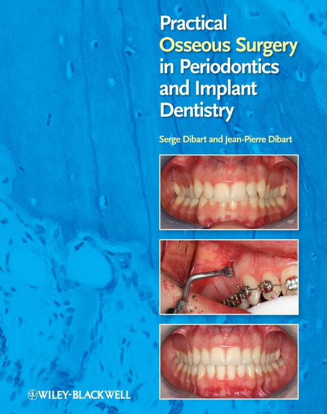 Front cover_Practical Osseous Surgery in Periodontics and Implant Dentistry