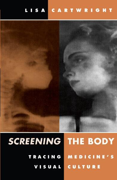 Front cover_Screening The Body
