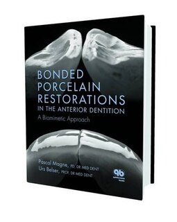 Couverture_Bonded Porcelain Restorations in the Anterior Dentition