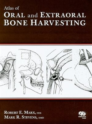 Front cover_Atlas of Oral and Extraoral Bone Harvesting