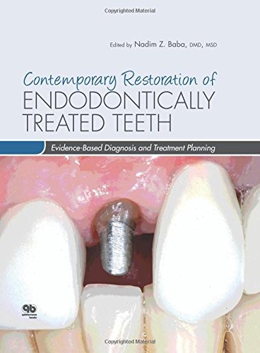Front cover_Contemporary Restoration Of Endodontically Treated Teeth