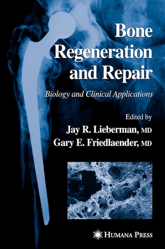 Front cover_Bone Regeneration and Repair