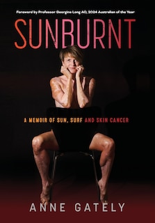 Couverture_Sunburnt