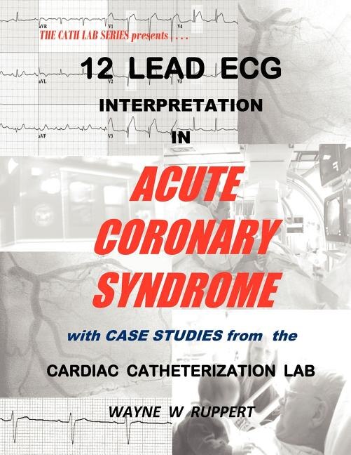 12 Lead ECG Interpretation in Acute Coronary Syndrome with Case Studies from the Cardiac