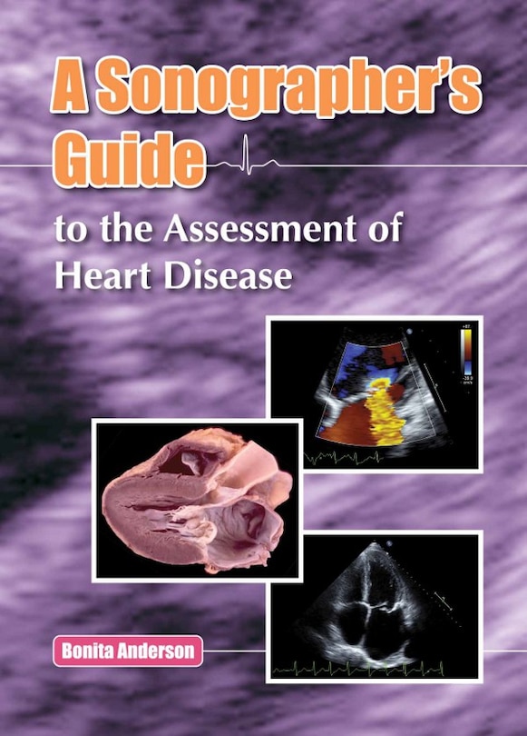 Front cover_A Sonographer's Guide To The Assessment Of Heart Disease